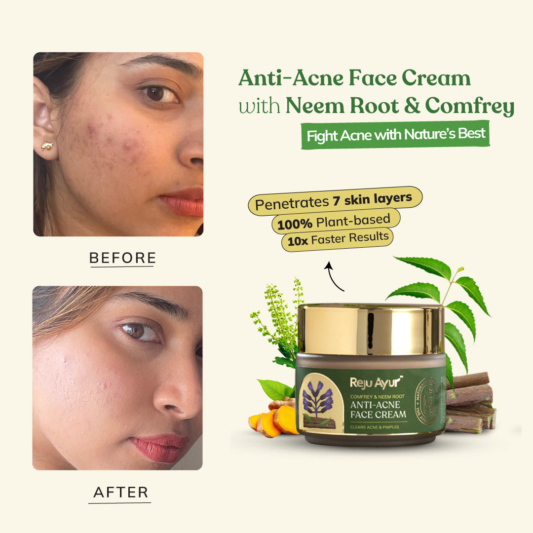 Anti-Acne Face Cream with Comfrey & Neem Root
