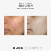 Face Wash Anti Acne 10ML
